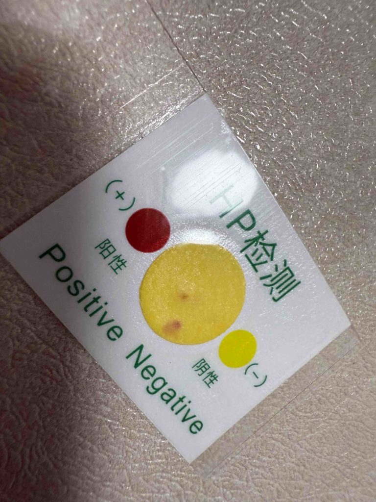 H. Pylori positive.... sigh...