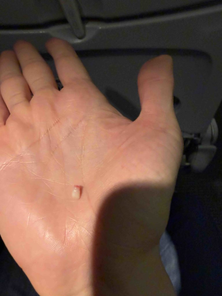 Luna dropped her first tooth on the plane on the way from Tokyo to Hokkaido!