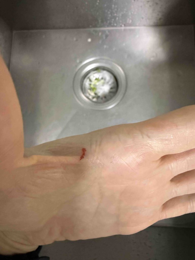 Ouch!